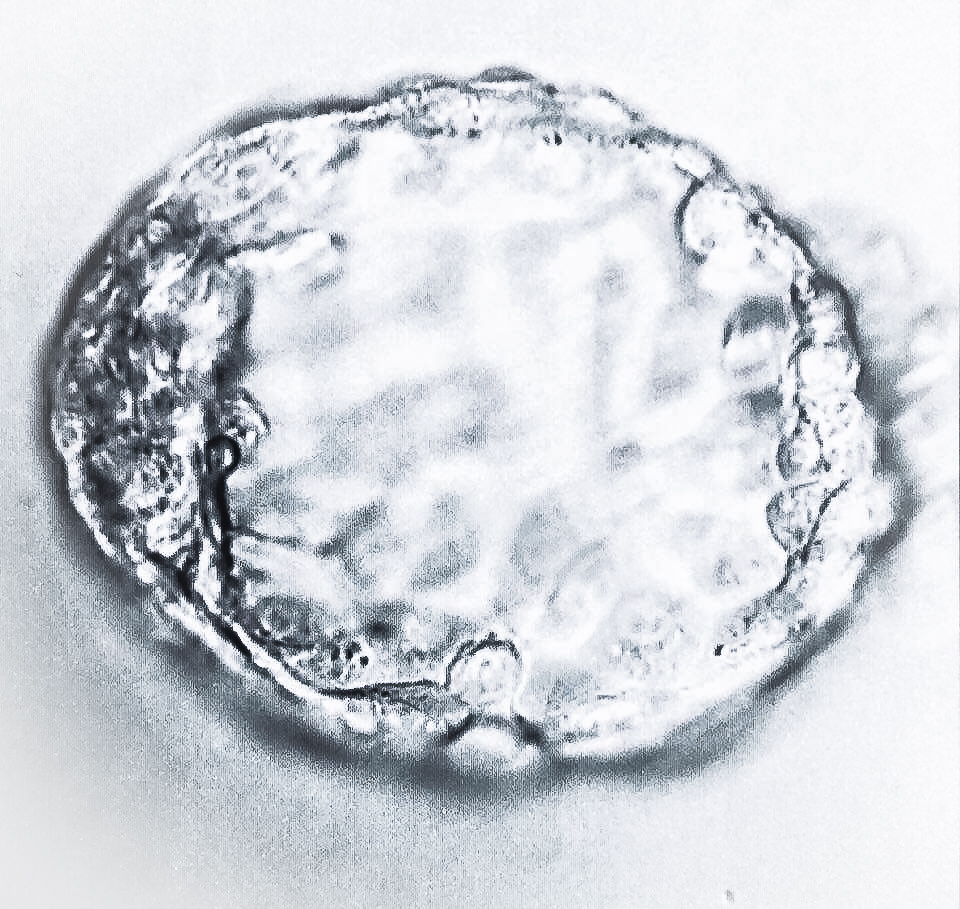 Leilani's first photo as a 5-day old blastocyst consisting of about 100 cells(!)